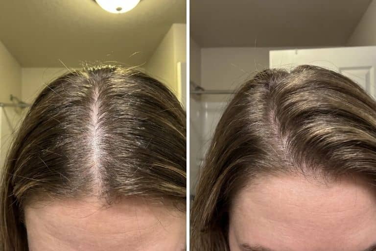My roots look fuller
